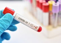 Académicas de Medicina UNAB velarán por la seguridad en proceso de investigación y pruebas relativas a vacunas COVID-19 en Chile